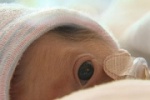 Image of a Premature Baby