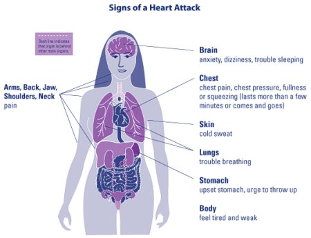 Female heart attack symptoms mayo